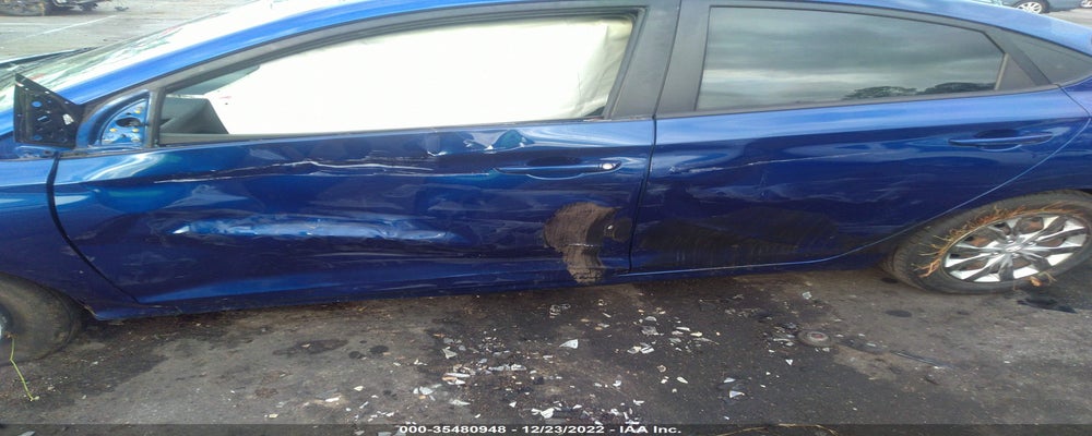3KPC24A36JE018499 2018 HYUNDAI ACCENT photo no. 6