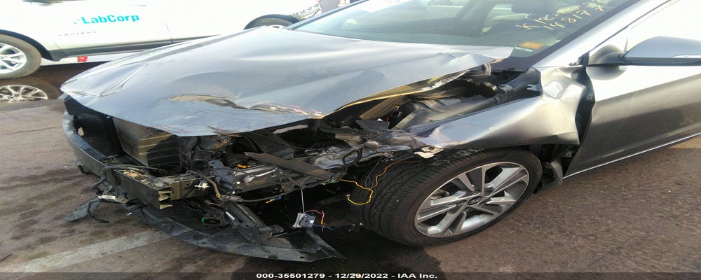 KMHD84LF7HU148177 2017 HYUNDAI ELANTRA photo no. 6