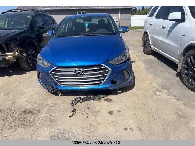 KMHD84LF7HU085906 Hyundai Elantra