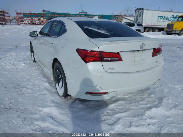 Acura Tlx Advance 2015 19UUB3F70FA801873 Image 3