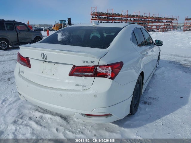 Acura Tlx Advance 2015 19UUB3F70FA801873 Image 4