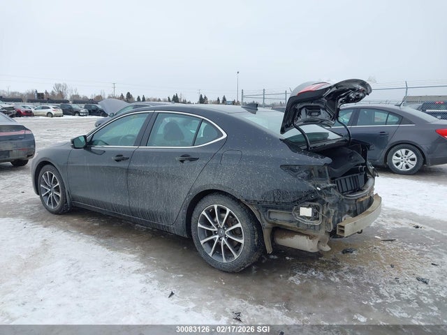 Acura Tlx Advance 2015 19UUB2F72FA800217 Image 3