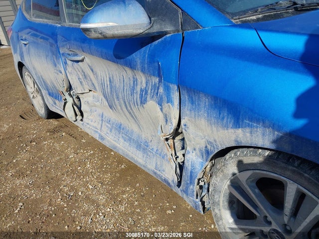 KMHD84LF4HU098080 Hyundai Elantra Se/value/limited