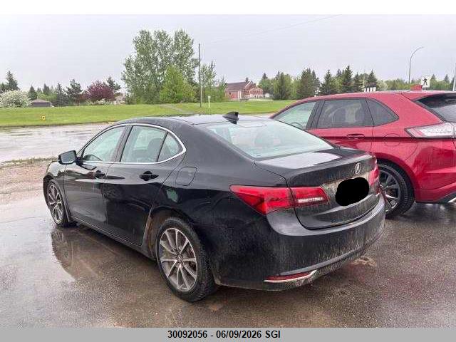 Acura TLX TECH 2015 19UUB3F57FA802811 Image 4