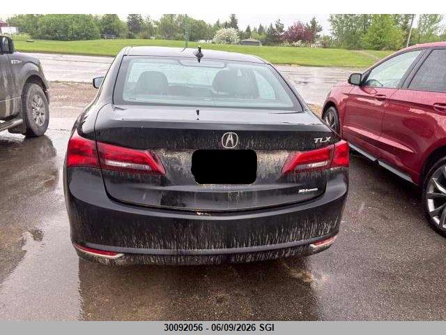 Acura TLX TECH 2015 19UUB3F57FA802811 Image 5