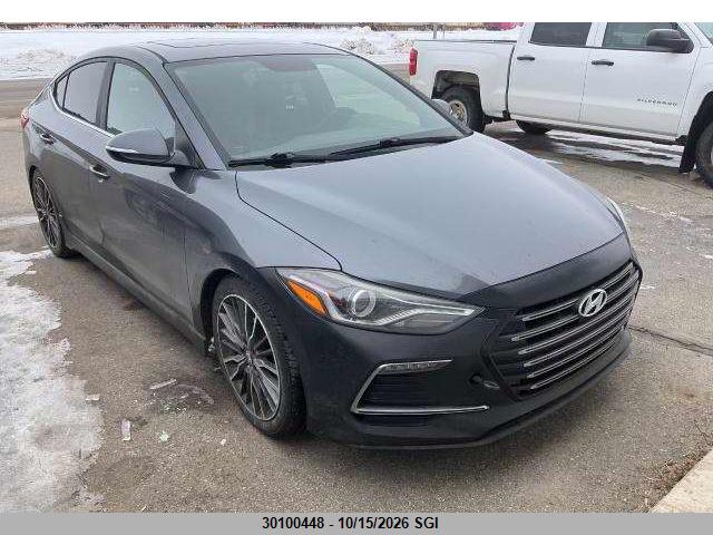 2017 KMHD04LB1HU354437 main image