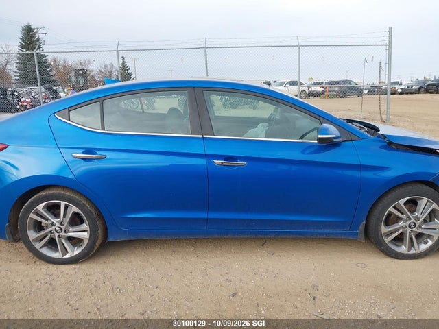 KMHD84LF9JU662621 Hyundai Elantra Sel/value/limited