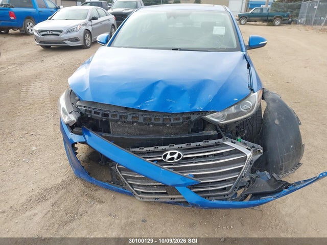 KMHD84LF9JU662621 Hyundai Elantra Sel/value/limited