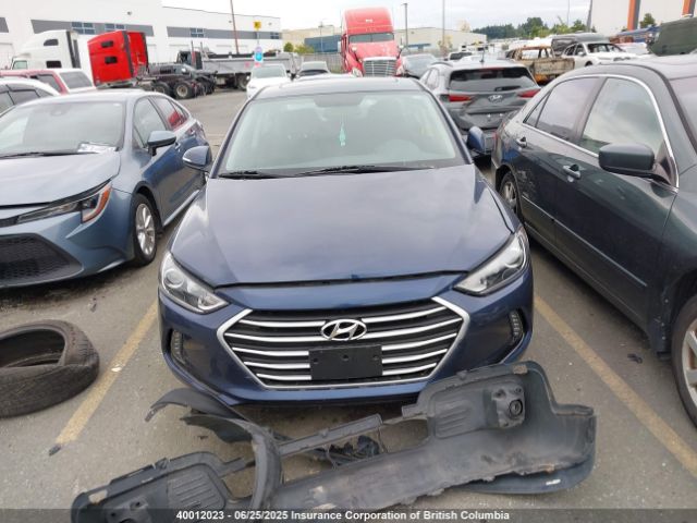 KMHD84LF4JU649467 Hyundai mpi nu