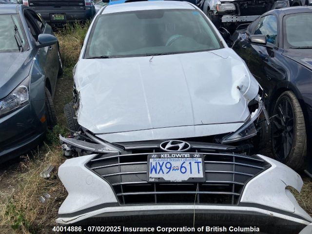 KMHD84LF9LU108403 Hyundai mpi nu