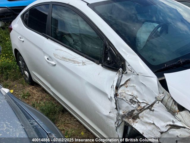 KMHD84LF9LU108403 Hyundai mpi nu