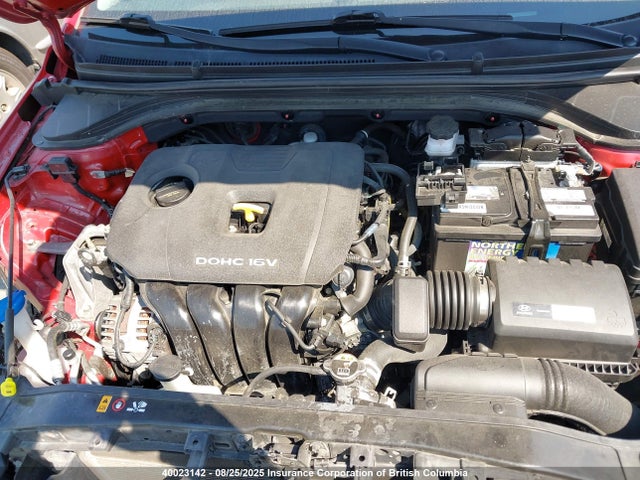 KMHD84LF4HU111037 Hyundai 2017