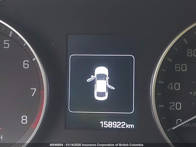 40046604 :رقم المزاد ، KMHD84LF5HU102959 vin ، 2017 Hyundai Elantra Se/value/limited مزاد بيع