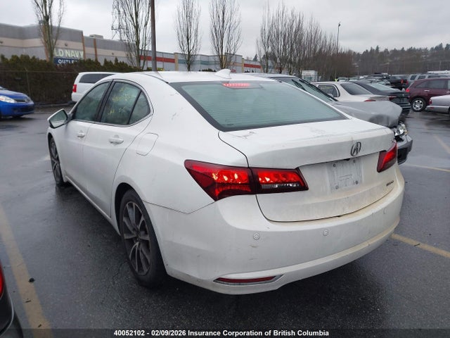 Acura TLX 2015 19UUB3F78FA802236 Image 3