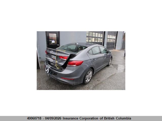 KMHD84LFXJU539006 Hyundai Elantra Gl Se