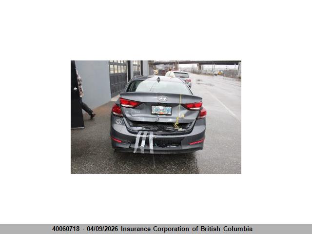 KMHD84LFXJU539006 Hyundai Elantra Gl Se