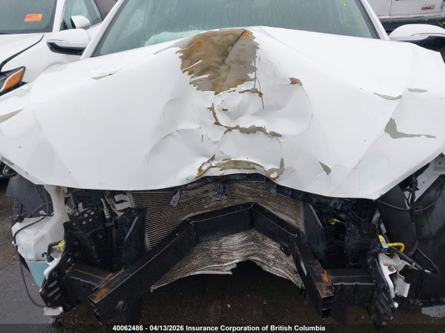 KMHD84LFXJU621561 Hyundai Elantra Sel/value/limited
