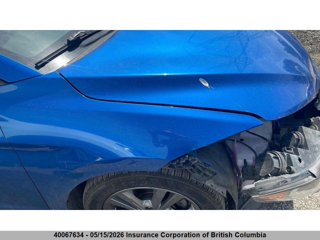 KMHD84LF3JU702028 Hyundai Elantra Sel/value/limited