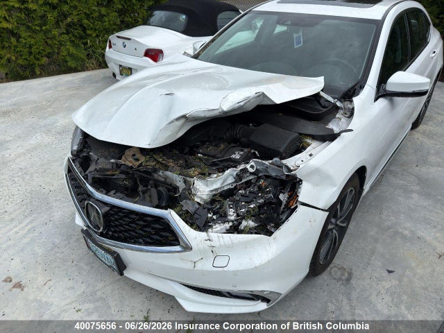 Acura TLX 2018 19UUB3F72JA800250 Image 11