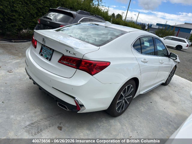 Acura TLX 2018 19UUB3F72JA800250 Image 4