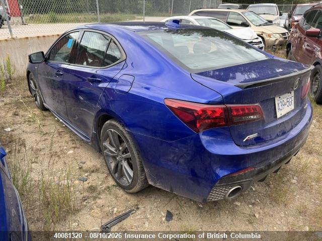 Acura TLX 2018 19UUB3F63JA801513 Image 3