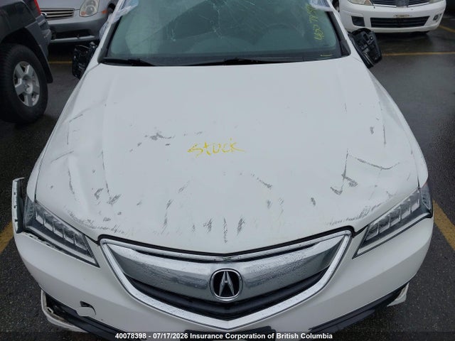 Acura TLX TECH 2017 19UUB3F52HA800158 Image 10