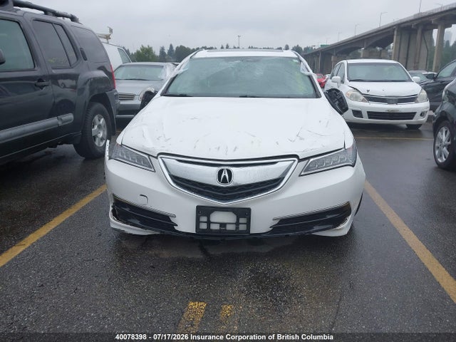 Acura TLX TECH 2017 19UUB3F52HA800158 Image 13