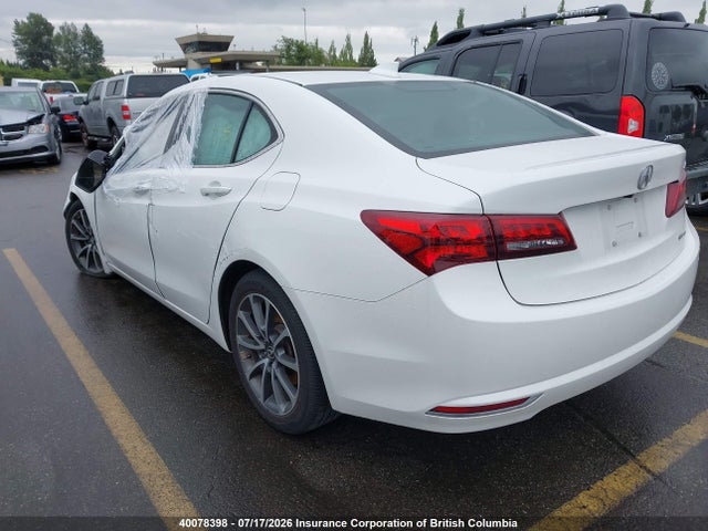 Acura TLX TECH 2017 19UUB3F52HA800158 Image 3