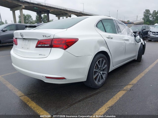 Acura TLX TECH 2017 19UUB3F52HA800158 Image 4