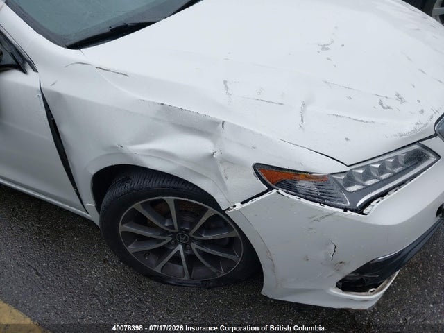 Acura TLX TECH 2017 19UUB3F52HA800158 Image 6