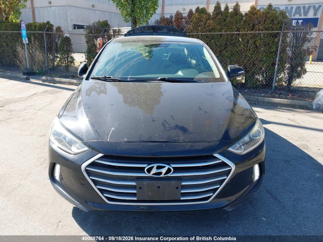 40088764 :رقم المزاد ، KMHD84LF3JU582537 vin ، 2018 Hyundai Elantra Sel/value/limited مزاد بيع