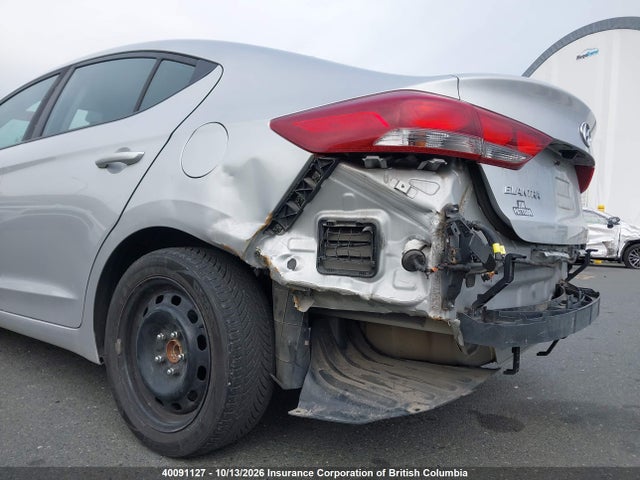 KMHD84LF7JU635157 Hyundai Elantra Sel/value/limited