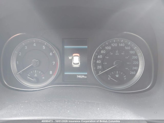 KM8K5CA59KU256988 Hyundai Kona 1.6t Ultimate