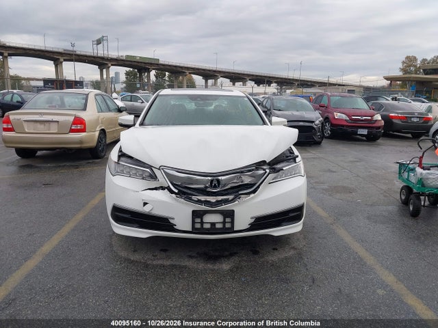 Acura TLX 2017 19UUB1F57HA800483 Image 13