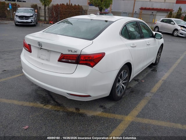 Acura TLX 2017 19UUB1F57HA800483 Image 4