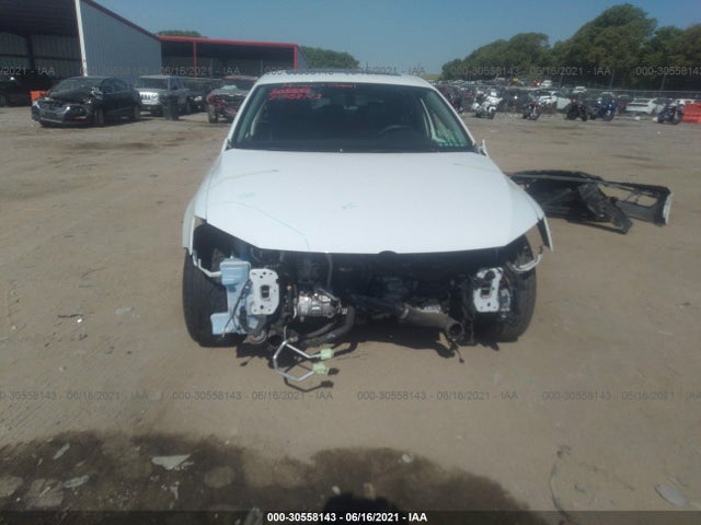 3VWL17AJ3HM380872 Volkswagen Jetta 1.8t Sel