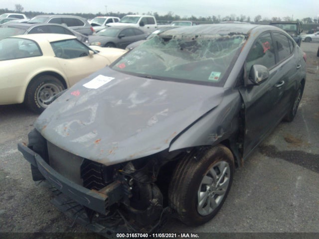 Hyundai ELANTRA SE 2017 KMHD74LFXHU371459 Image 2