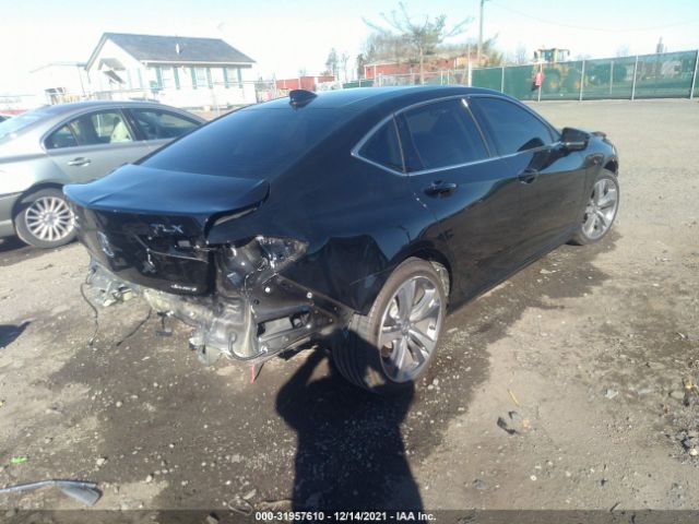 19UUB6F65MA005271 Acura Tlx W/advance Package