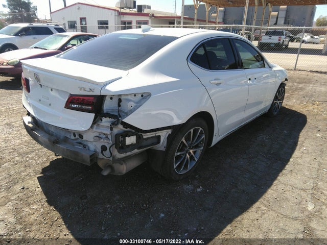2017 Acura TLX, VIN: 19UUB2F59HA005845