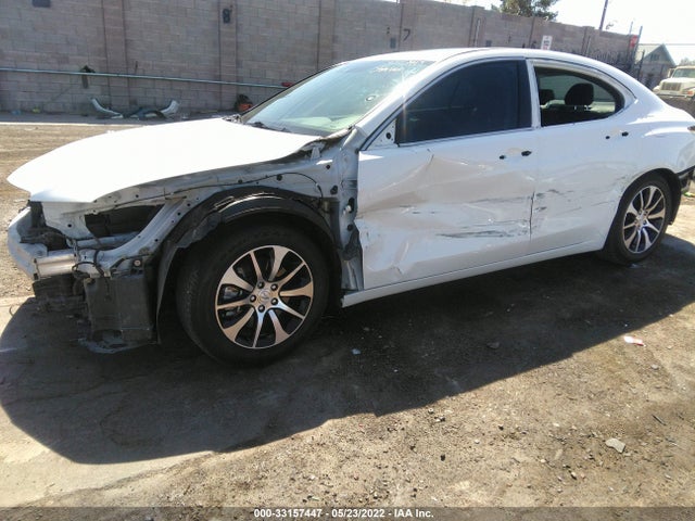 Acura Tlx W/technology Pkg 2017 19UUB1F50HA010295 Image 6