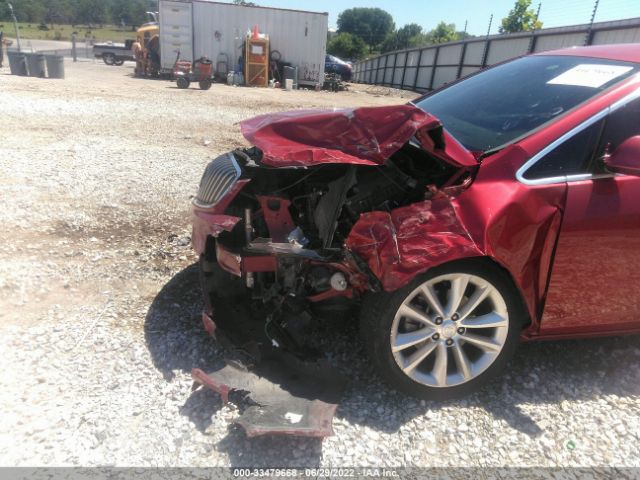 1G4PR5SK0E4192676 Buick Verano Convenience Group