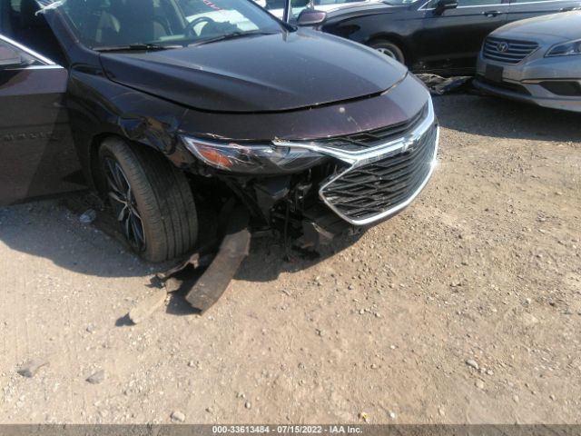 1G1ZG5ST7LF151659 Chevrolet Malibu Fwd Rs