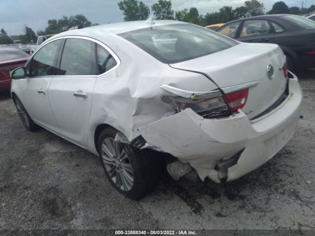 1G4PP5SK9E4172965 Buick Verano