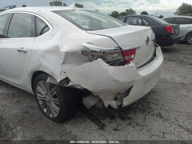 1G4PP5SK9E4172965 Buick Verano