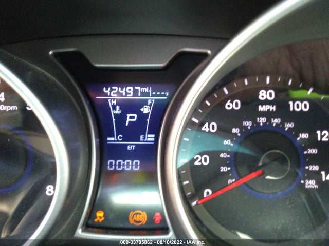 2017 Hyundai Veloster, VIN: KMHTC6ADXHU311010