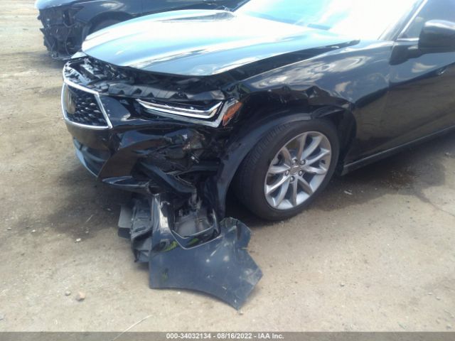 19UUB5F36MA004162 Acura TLX