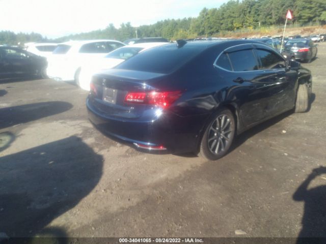 19UUB3F5XFA000205 Acura Tlx V6 Tech