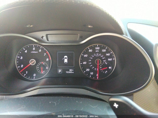 2016 Hyundai Veloster, VIN: KMHTC6AE8GU279374
