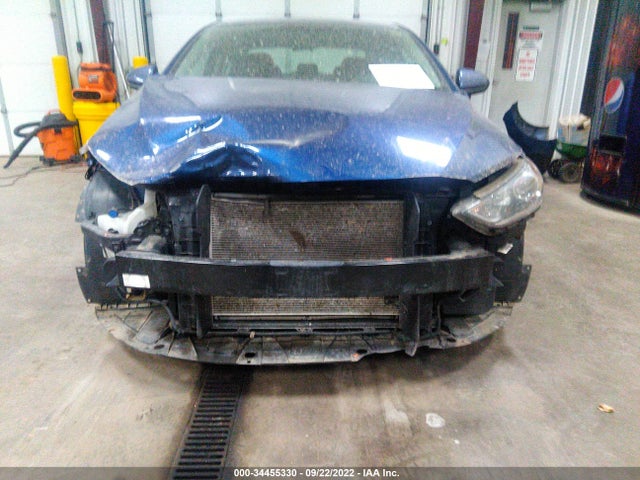 Hyundai ELANTRA SE 2017 5NPD84LFXHH157728 Image 6