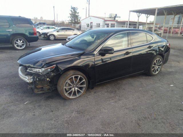 19UUB2F31HA004865 Acura Tlx V6